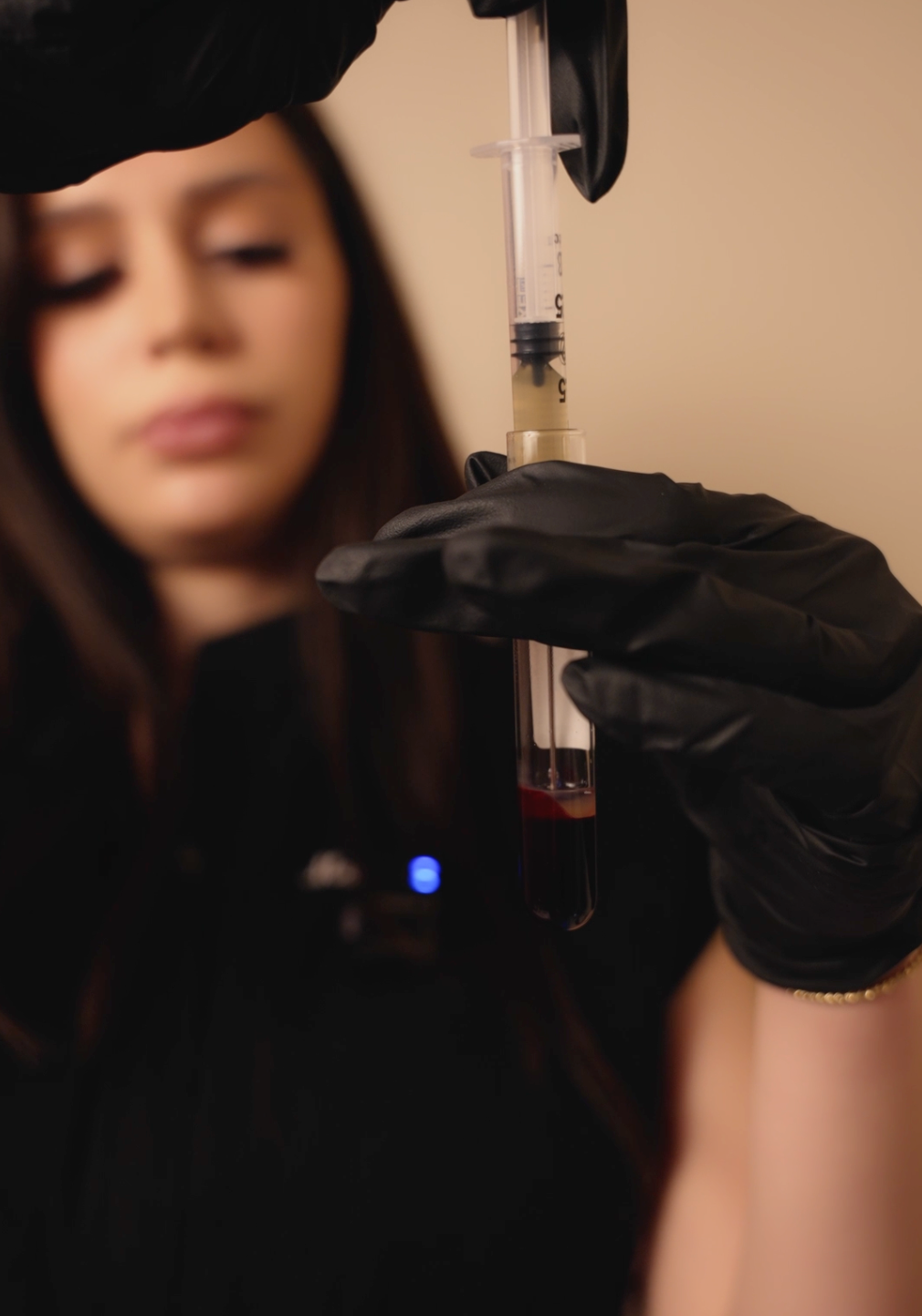 PRP Microneedling