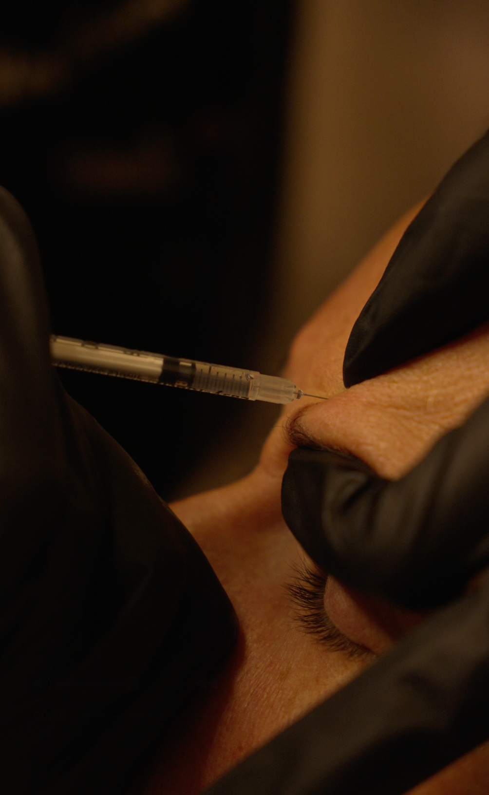 Botox 120 Units