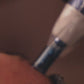 Microneedling + Rejuran (Salmon DNA)